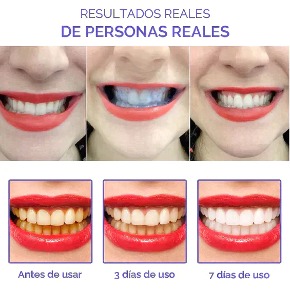 Smile Kit Advertorial - 14