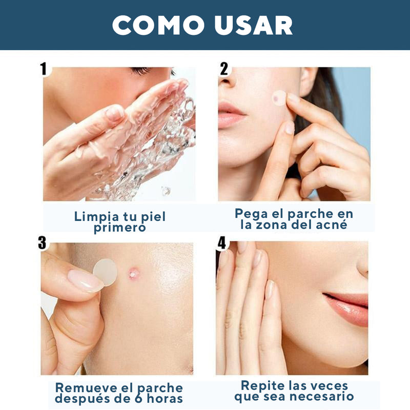 PARCHES PARA ACNE